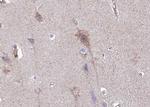 Phospho-IGFBP3 (Ser183) Antibody in Immunohistochemistry (Paraffin) (IHC (P))