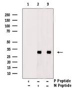 Phospho-IGFBP3 (Ser183) Antibody in Western Blot (WB)