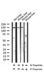 Phospho-PLCG1 (Tyr783) Antibody in Western Blot (WB)