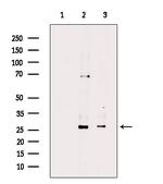 Phospho-Cardiac Troponin I (Ser44) Antibody in Western Blot (WB)