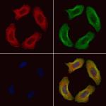 Phospho-Filamin A (Ser2152) Antibody in Immunocytochemistry (ICC/IF)