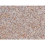 Phospho-Filamin A (Ser2152) Antibody in Immunohistochemistry (Paraffin) (IHC (P))