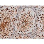 Phospho-Filamin A (Ser2152) Antibody in Immunohistochemistry (Paraffin) (IHC (P))