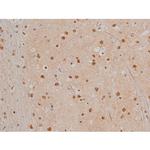 Phospho-Filamin A (Ser2152) Antibody in Immunohistochemistry (Paraffin) (IHC (P))