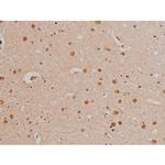 Phospho-Filamin A (Ser2152) Antibody in Immunohistochemistry (Paraffin) (IHC (P))