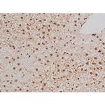 Phospho-Filamin A (Ser2152) Antibody in Immunohistochemistry (Paraffin) (IHC (P))