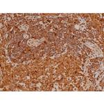 Phospho-Filamin A (Ser2152) Antibody in Immunohistochemistry (Paraffin) (IHC (P))