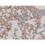 Phospho-Filamin A (Ser2152) Antibody in Immunohistochemistry (Paraffin) (IHC (P))