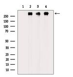 Phospho-Filamin A (Ser2152) Antibody in Western Blot (WB)