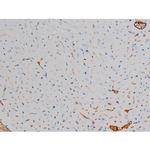 Phospho-p70 S6 Kinase (Ser371) Antibody in Immunohistochemistry (Paraffin) (IHC (P))