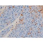 Phospho-p70 S6 Kinase (Ser371) Antibody in Immunohistochemistry (Paraffin) (IHC (P))