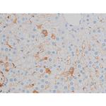 Phospho-p70 S6 Kinase (Ser371) Antibody in Immunohistochemistry (Paraffin) (IHC (P))