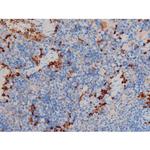 Phospho-p70 S6 Kinase (Ser371) Antibody in Immunohistochemistry (Paraffin) (IHC (P))