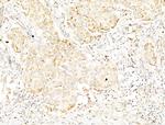 Phospho-p70 S6 Kinase (Thr389, Thr412) Antibody in Immunohistochemistry (Paraffin) (IHC (P))