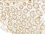 Phospho-p70 S6 Kinase (Thr389, Thr412) Antibody in Immunohistochemistry (Paraffin) (IHC (P))