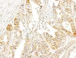 Phospho-p70 S6 Kinase (Thr389, Thr412) Antibody in Immunohistochemistry (Paraffin) (IHC (P))