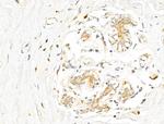 Phospho-p70 S6 Kinase (Thr389, Thr412) Antibody in Immunohistochemistry (Paraffin) (IHC (P))