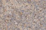 Phospho-p70 S6 Kinase (Ser447) Antibody in Immunohistochemistry (Paraffin) (IHC (P))