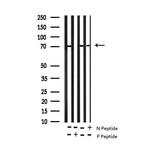 Phospho-p70 S6 Kinase (Ser447) Antibody in Western Blot (WB)