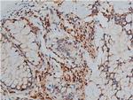 Phospho-GATA3 (Ser308) Antibody in Immunohistochemistry (Paraffin) (IHC (P))