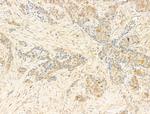 Phospho-CDK2 (Thr160) Antibody in Immunohistochemistry (Paraffin) (IHC (P))