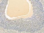 Phospho-CDK2 (Thr160) Antibody in Immunohistochemistry (Paraffin) (IHC (P))