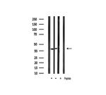 Phospho-IKB alpha (Tyr305) Antibody in Western Blot (WB)