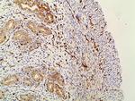 Phospho-PI3K p85 alpha (Tyr607) Antibody in Immunohistochemistry (Paraffin) (IHC (P))