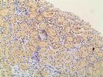 Phospho-PI3K p85 alpha (Tyr607) Antibody in Immunohistochemistry (Paraffin) (IHC (P))