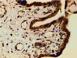 Phospho-PI3K p85 alpha (Tyr607) Antibody in Immunohistochemistry (Paraffin) (IHC (P))