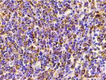 Phospho-PI3K p85 alpha (Tyr607) Antibody in Immunohistochemistry (Paraffin) (IHC (P))