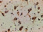 Phospho-PI3K p85 alpha (Tyr607) Antibody in Immunohistochemistry (Paraffin) (IHC (P))