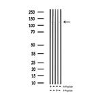 Phospho-eNOS (Thr495) Antibody in Western Blot (WB)