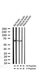 Phospho-CDC25B (Ser323) Antibody in Western Blot (WB)