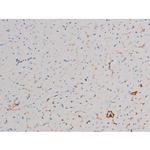 Phospho-AKT1 (Thr450) Antibody in Immunohistochemistry (Paraffin) (IHC (P))