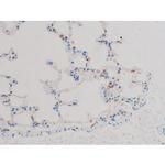 Phospho-AKT1 (Thr450) Antibody in Immunohistochemistry (Paraffin) (IHC (P))