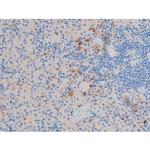 Phospho-AKT1 (Thr450) Antibody in Immunohistochemistry (Paraffin) (IHC (P))