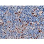 Phospho-AKT1 (Thr450) Antibody in Immunohistochemistry (Paraffin) (IHC (P))