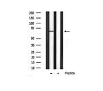 Phospho-AKT1 (Thr450) Antibody in Western Blot (WB)