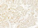 Phospho-AKT1/AKT2/AKT3 (Thr308) Antibody in Immunohistochemistry (Paraffin) (IHC (P))