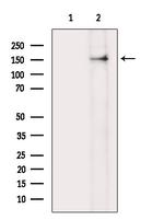 Phospho-beta Catenin (Ser37) Antibody in Western Blot (WB)