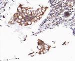 Phospho-beta Catenin (Ser37) Antibody in Immunohistochemistry (Paraffin) (IHC (P))