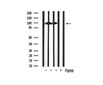 Phospho-beta Catenin (Ser37) Antibody in Western Blot (WB)