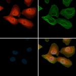 Phospho-NF2 (Ser518) Antibody in Immunocytochemistry (ICC/IF)