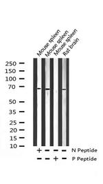 Phospho-NF2 (Ser518) Antibody in Western Blot (WB)