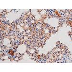 Phospho-IRS1 (Ser636) Antibody in Immunohistochemistry (Paraffin) (IHC (P))