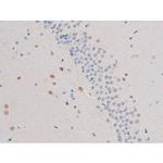 Phospho-IRS1 (Ser636) Antibody in Immunohistochemistry (Paraffin) (IHC (P))