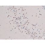 Phospho-IRS1 (Ser636) Antibody in Immunohistochemistry (Paraffin) (IHC (P))