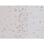 Phospho-IRS1 (Ser636) Antibody in Immunohistochemistry (Paraffin) (IHC (P))