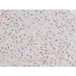 Phospho-IRS1 (Ser636) Antibody in Immunohistochemistry (Paraffin) (IHC (P))